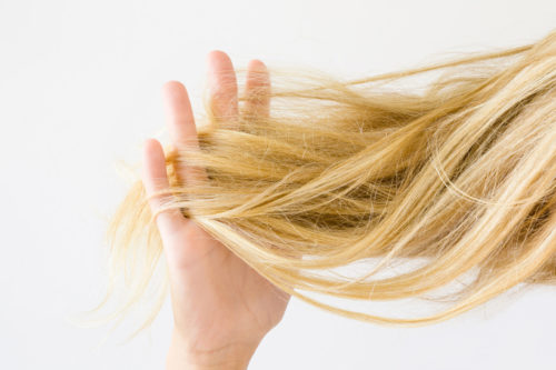 Hormonal Imbalance Hair Loss in Women 