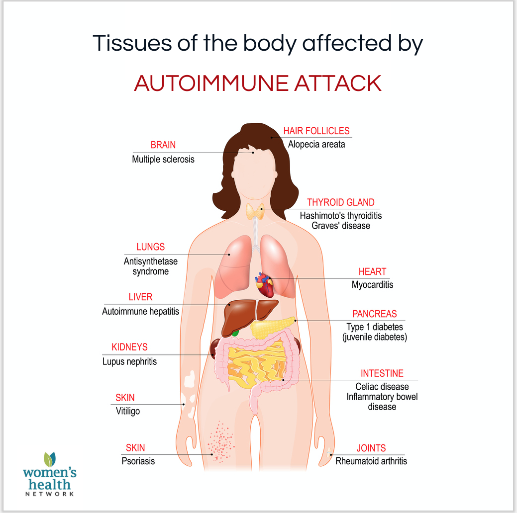 An immune health infographic showing tissues affected by autoimmune attack